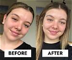 Before and After Photo |