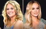 Carrie Underwood's Surgery Journey Explored
