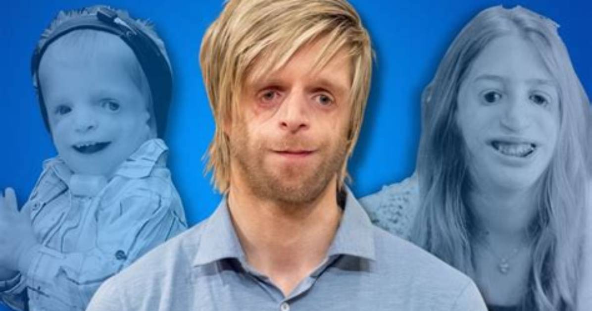 Courageous Faces: Celebrities with Treacher Collins Syndrome