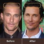 Decoding Matthew Mcconaughey's Hair Revival: Secrets and Solutions Unveiled