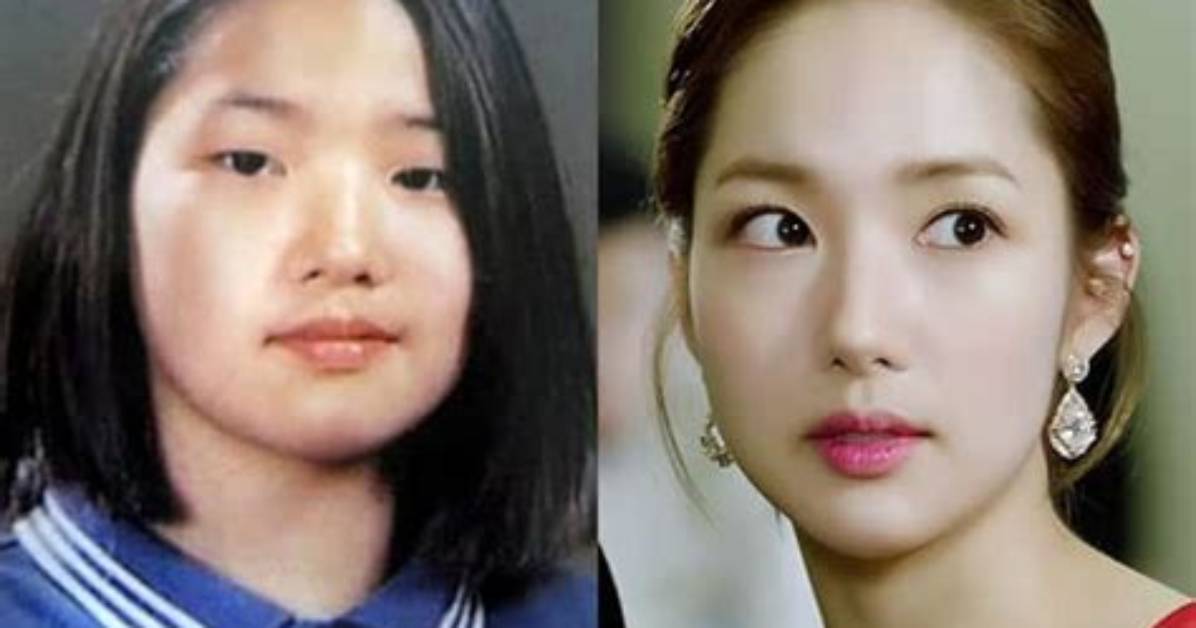 Did Park Min Young Have Plastic Surgery? Park Min Young Before and After