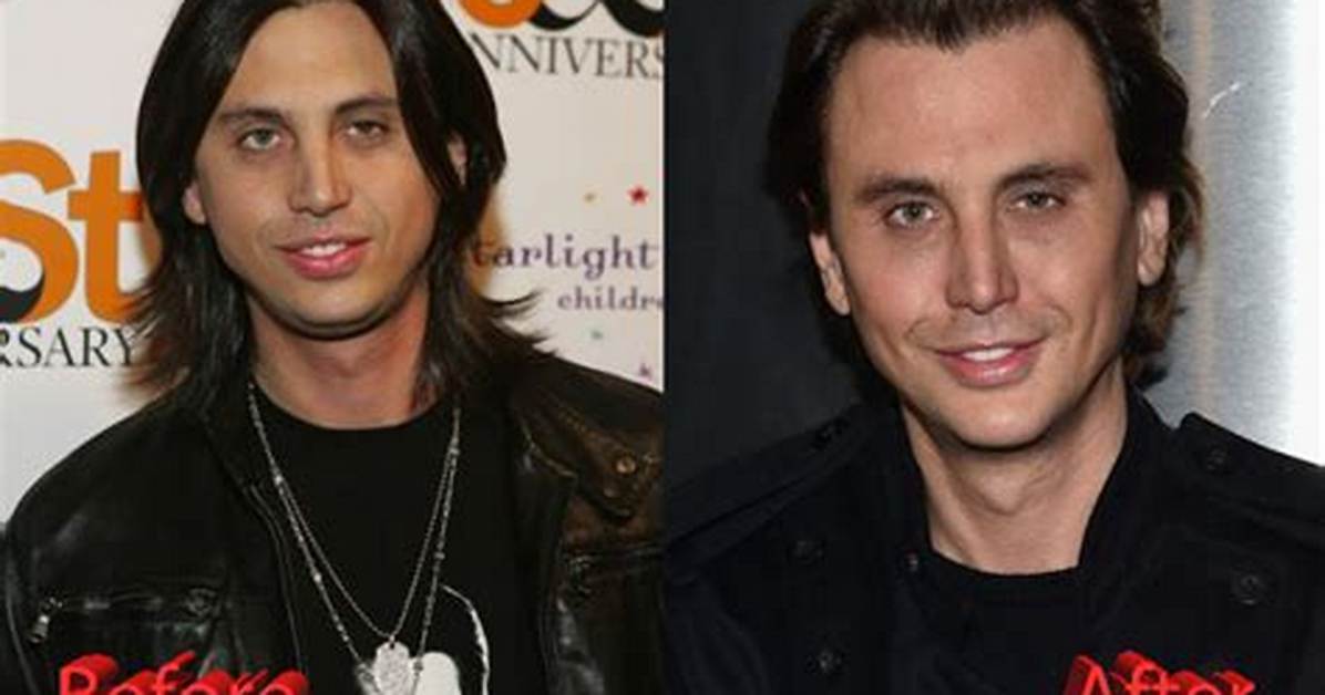 Discover Jonathan Cheban's Transformation: Before and After Uncovered
