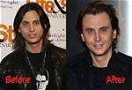 Discover Jonathan Cheban's Transformation: Before and After Uncovered