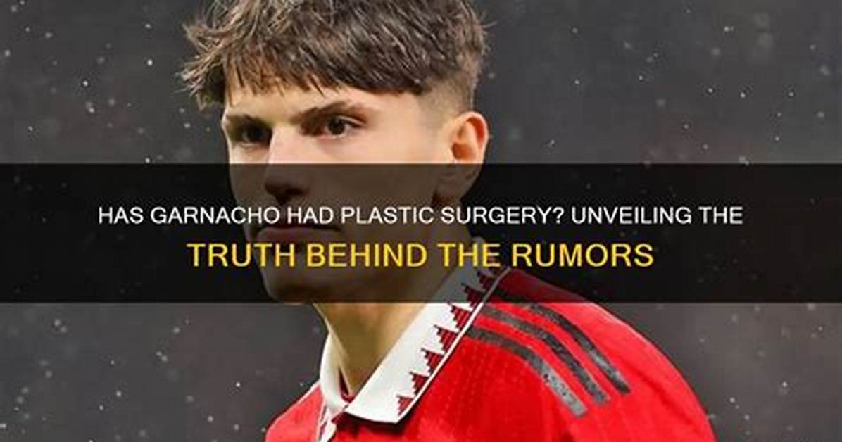 Examining the Rumors: Has Garnacho Had Plastic Surgery?