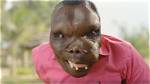 Godfrey Baguma: the Face of Resilience and Inspiration