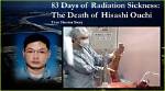 Hisashi Ouchi Real Photo: Understanding the Tragic Story Behind the Image