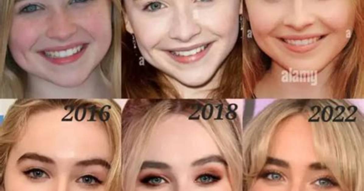 Inside the Transformation: Sabrina Carpenter's Plastic Surgery Journey