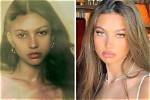 Katarina Deme Plastic Surgery Viral on Tiktok | Before and After Photo