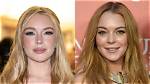 Lindsay Lohan's Plastic Surgery Journey Revealed