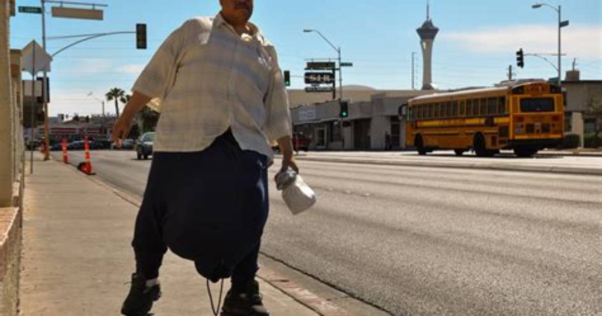 Man with Five Stone Testicles Update Today |