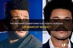 Plastic Surgery or Makeup Magic?