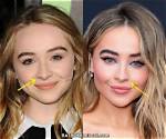 Sabrina Carpenter Nose Surgery: Transformation and Controversy