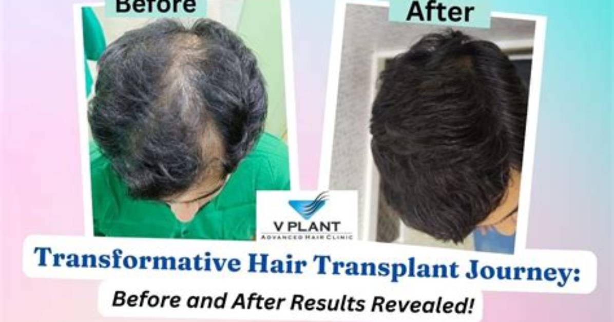 Transformative Journey: Before and After Fenugreek