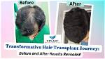 Transformative Journey: Before and After Fenugreek