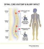 Understanding T12 Spinal Cord Injury: Impacts and Rehabilitation