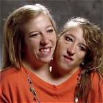 Unraveling the Mystery: Have Abby and Brittany Hensel Died?
