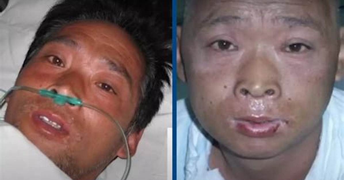 Unraveling the Mystery of Hisashi Ouchi Leak: a Deep Dive into a Tragic Incident