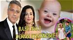 Unraveling the Truth: Do George Clooney's Children Face Down Syndrome's Challenges?