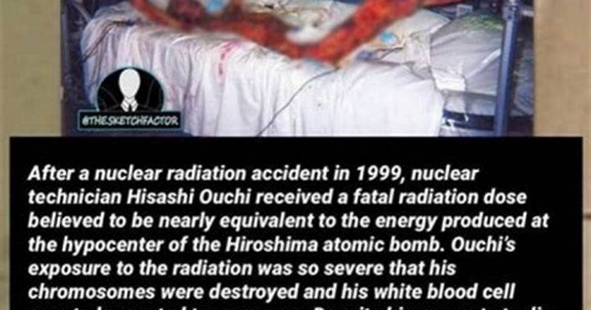 Unveiling Hisashi Ouchi: a Journey Through Hisashi Ouchi Images