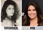 Unveiling Kimberly Guilfoyle's Journey Through Plastic Surgeries