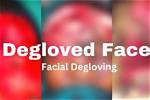 Unveiling the Horrors: Understanding the Degloved Face💀