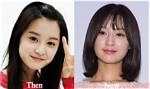 Unveiling the Transformation: Kim Ji-Won Before Surgery