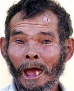 Unveiling the "Ugliest Man in the World"