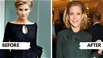 What Happened to Amanda Staveley Face? Huntington’s Disease Symptoms